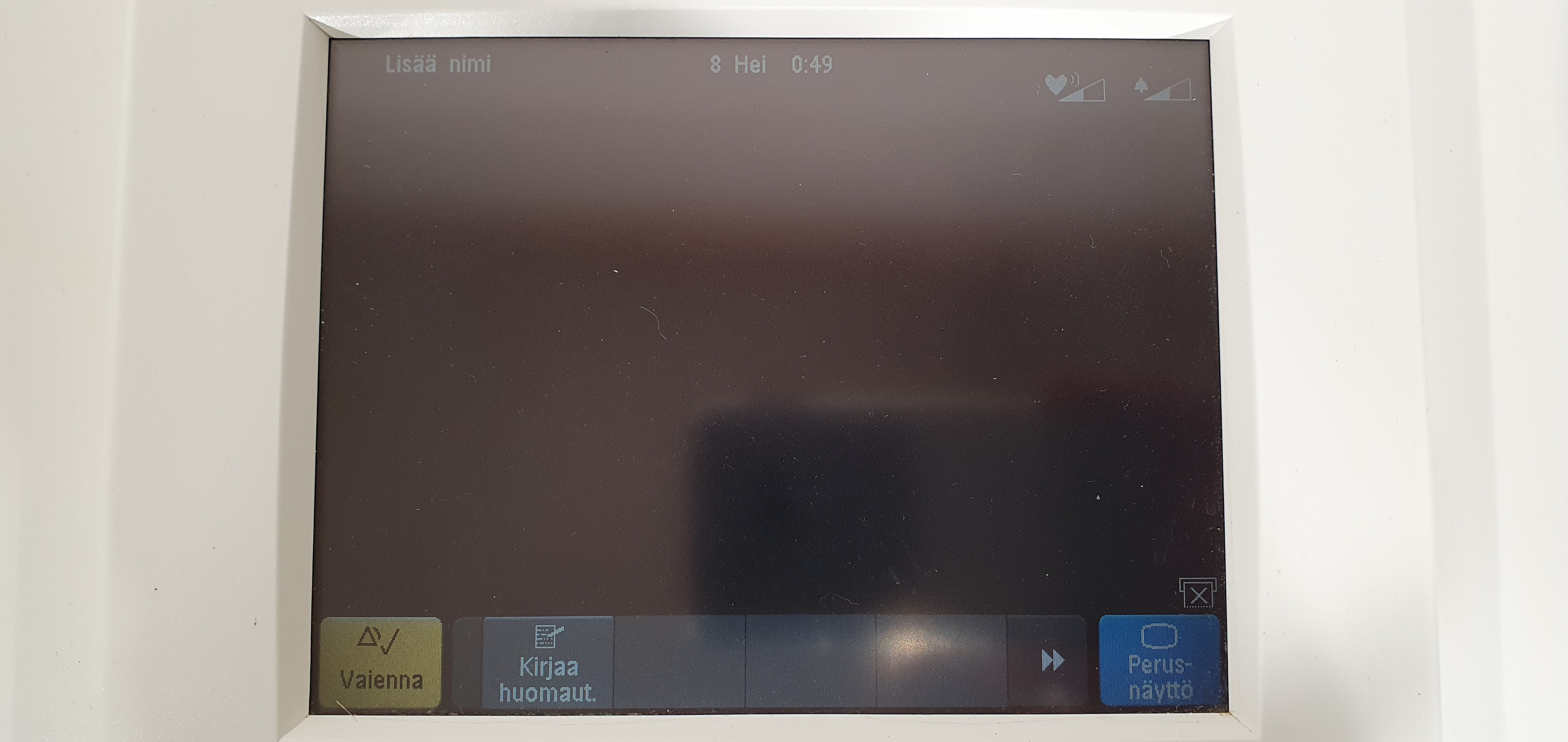 Cardiotocograph, fetal monitor, fetal and maternal monitor – Foto 16, Rideen